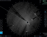 Bright echoes are other ships with black shadow areas behind them. Dark area shown on the right side of the heading line is oil spill. 